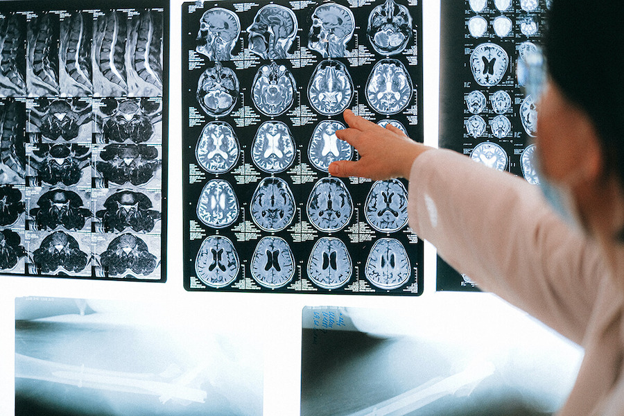 Diagnostic par IA